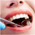 Protecting the Health of your Teeth with General Dentistry