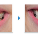 Three Benefits of Professional Teeth Whitening
