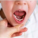 When is It Safe to Start Flossing My Child’s Teeth?