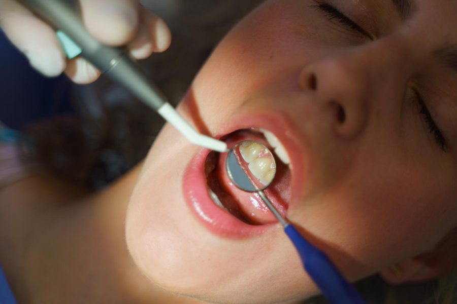 Curodont in Los Angeles_ A Non-Invasive Approach to Treating Early Tooth Decay