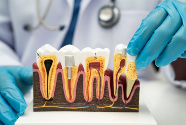 Supporting Natural Enamel Repair Without Drilling