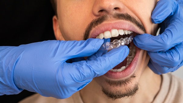 Invisalign Dentist in Los Angeles