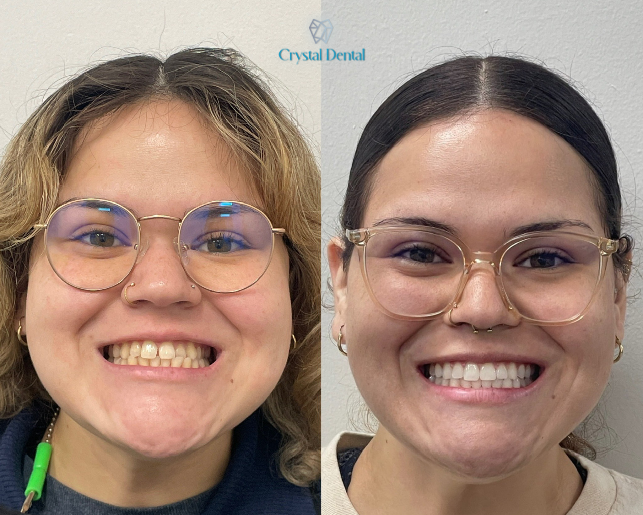 crystaldentalcenters 1 (1)