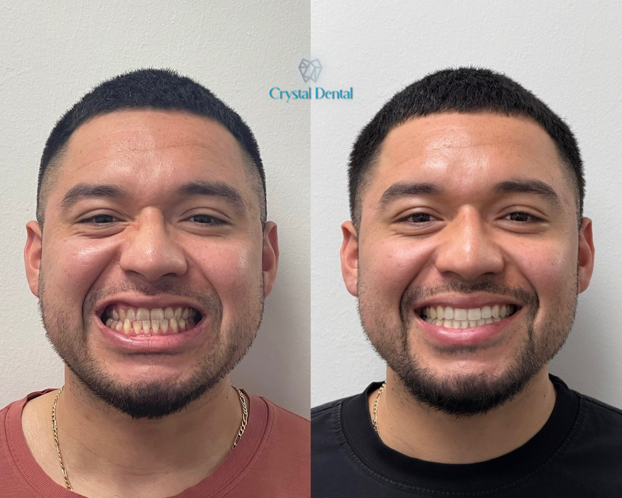 crystaldentalcenters 1