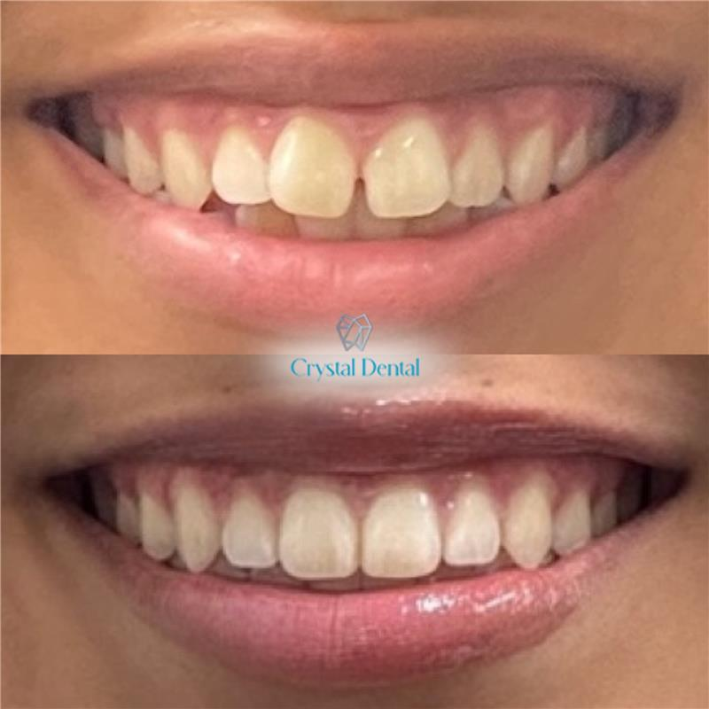 crystaldentalcenters 12