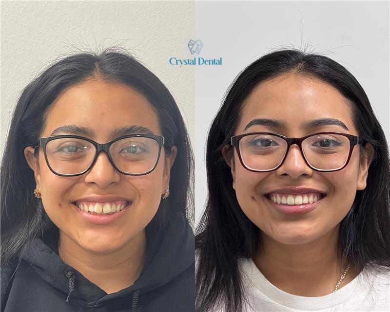 crystaldentalcenters 4