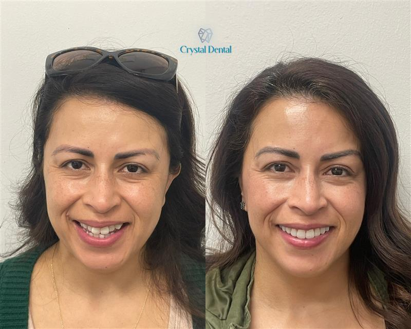 crystaldentalcenters